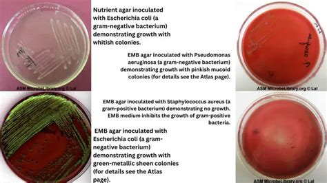 emb agar results|how to grow bacteria in a lab.